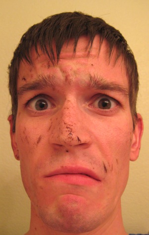 wysz's face, covered in brown spots