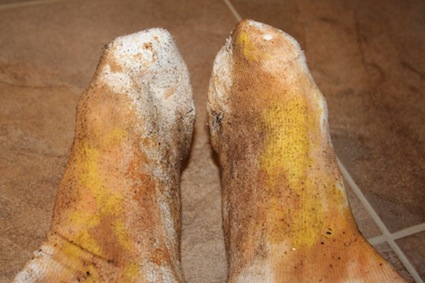 dirty socks
